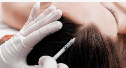 Exosome Patented Technology for Hair Growth